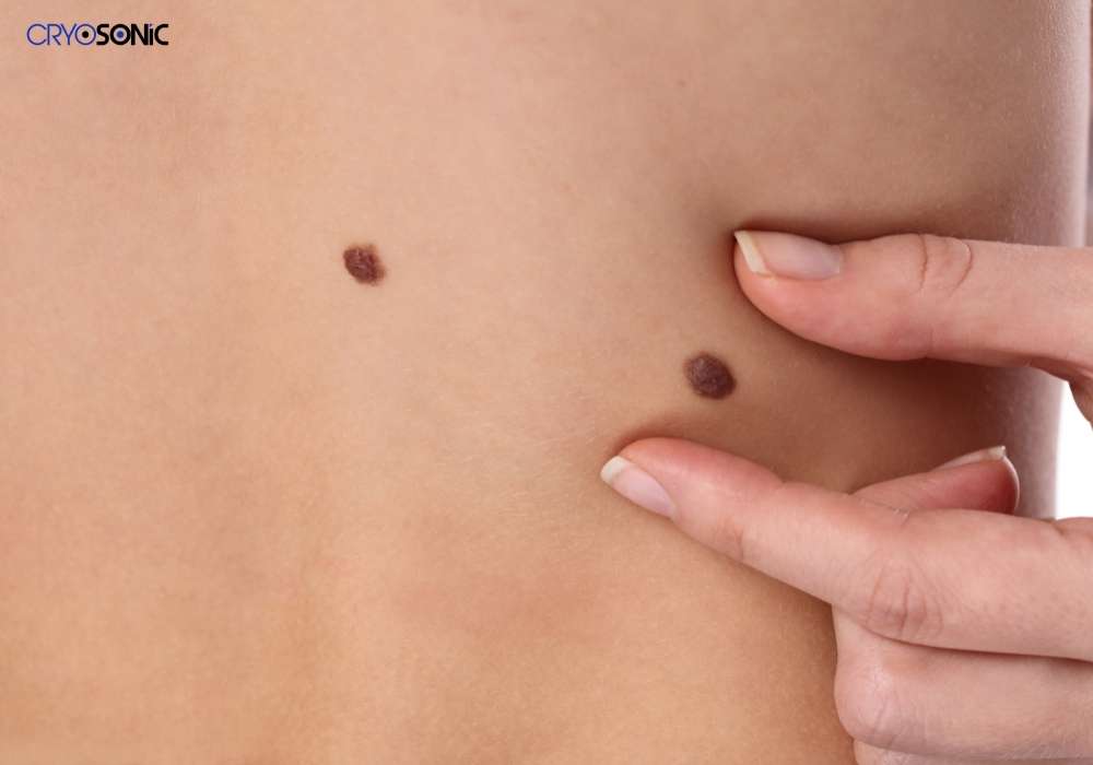 Infection Risk and Poor Aftercare Eastleigh