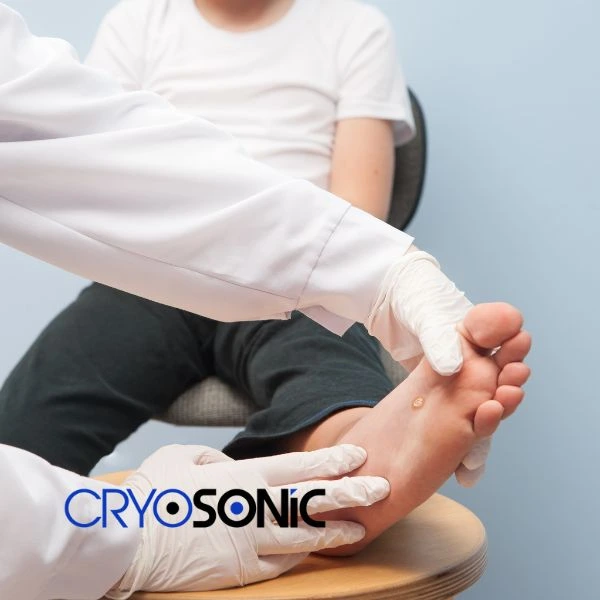 Are you looking for fast effective wart removal Contact us today Eastleigh